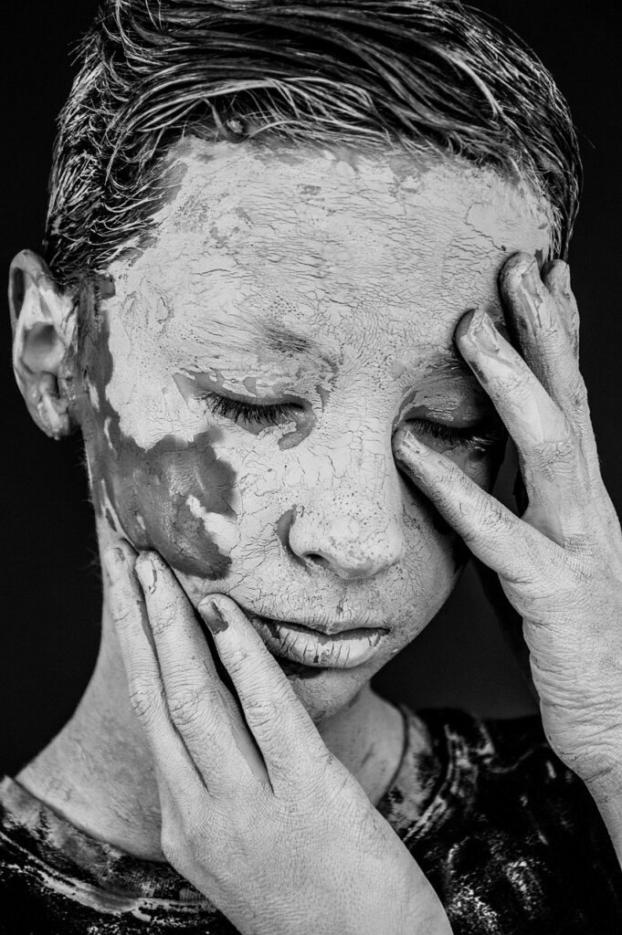 デリケートゾーンの色素沈着にハイドロキノンは効果的ですか？