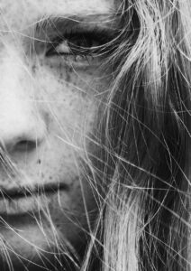 敏感肌の人がVIOの黒ずみに毎日塗るとどうなる？