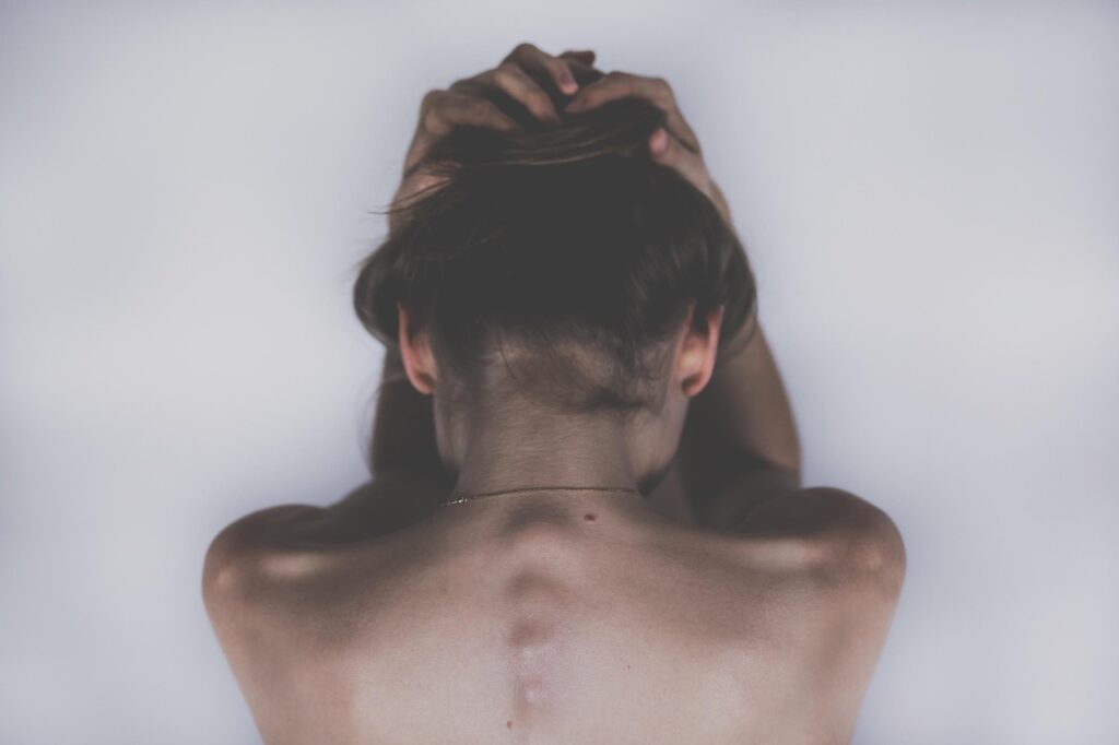 敏感肌のVIO黒ずみを介護脱毛で解消するケア方法は？