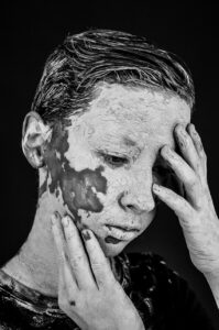 敏感肌の人が知っておくべきVIOの黒ずみと色素沈着の見分け方は？