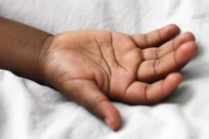 敏感肌の人が知りたいVIOの黒ずみと皮膚が黒い原因、急に気になる時の対策は？